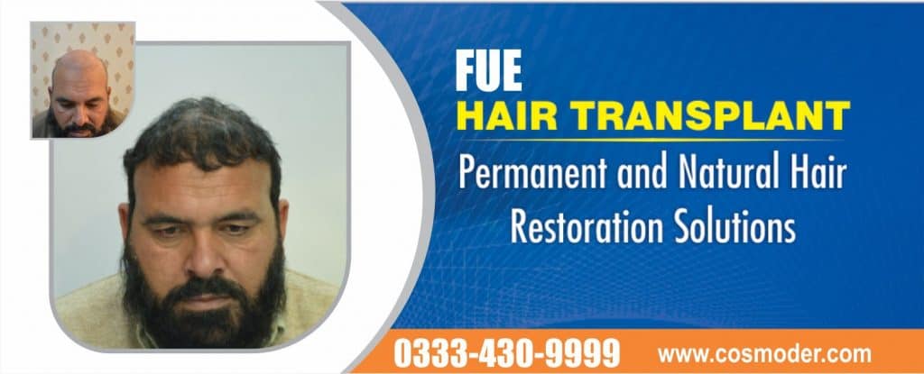 Fue hair transplant clinic pakistan