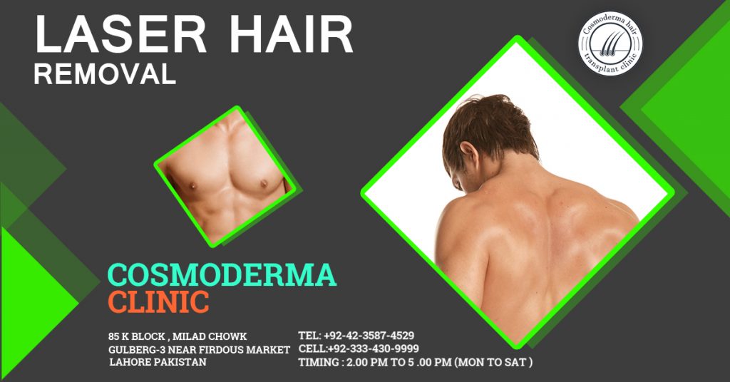Laser hair removal Lahore