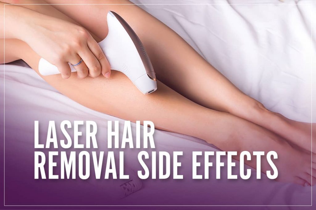 Laser hair removal side effects