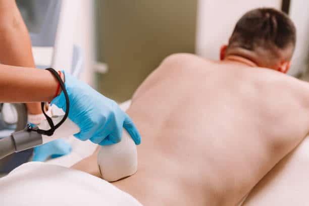 Back hair removal laser treatment