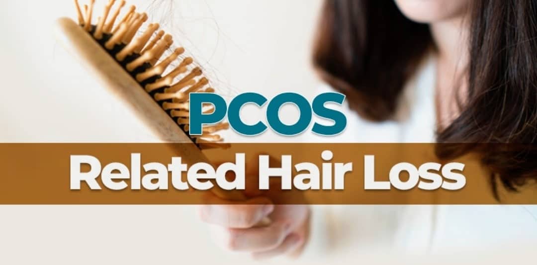 Polycystic ovary and hair loss | Specialit treatment clinic Lahore Pakistan