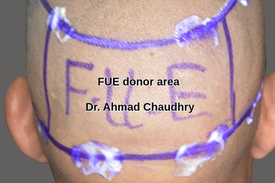 Faisalabad patient donor area