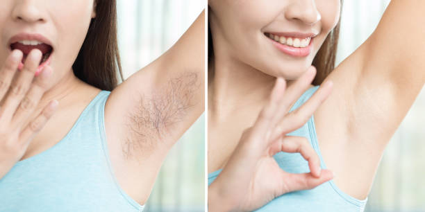 IPL hair removal clinic Lahore