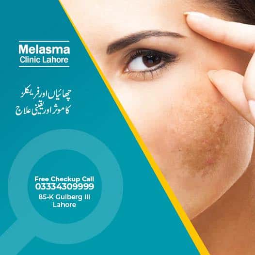 Permanent pigmentation removal expert Lahore