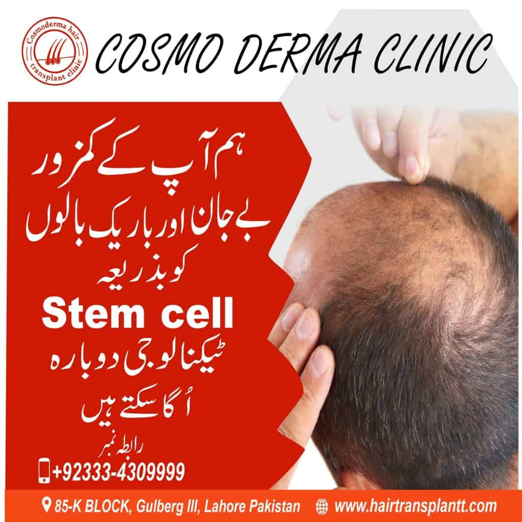 Hair Loss Hair Loss